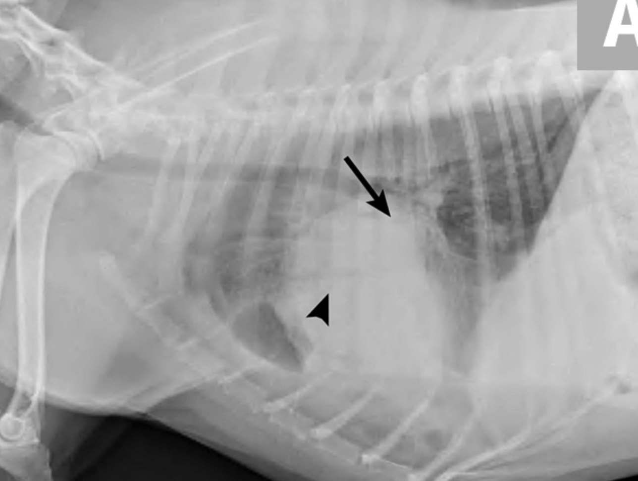 Líquido en los pulmones en un adulto mayor: causas y síntomas comunes