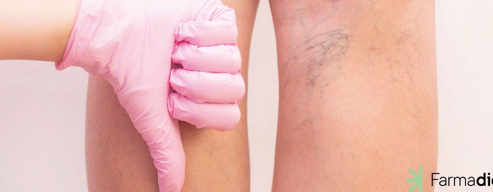 ¿Qué causa la mala circulación en los pies en el adulto mayor?